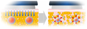 cavitation ellectrode